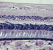 Ophthalmic Ophthalmic